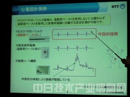 NTT开发出可嵌入内衣随时获取心律及心电图信