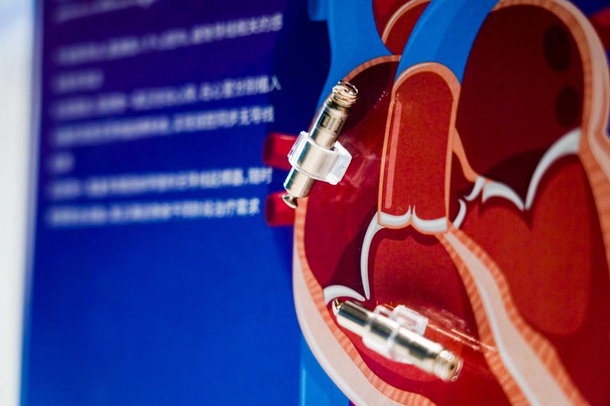 雅培AVEIR? DR双腔植入式无导线心脏起搏器系统即将在第六届进博会上进行亚洲首秀。受访方供图